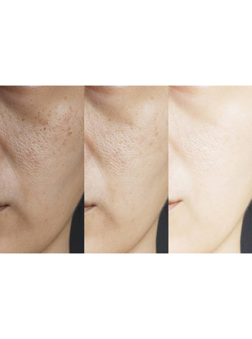 Gluta Pure C Intensive Serum - Trillium